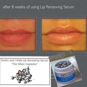 After 8 Weeks Lip Serum